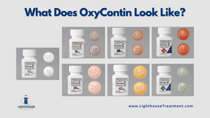 Oxy stock price